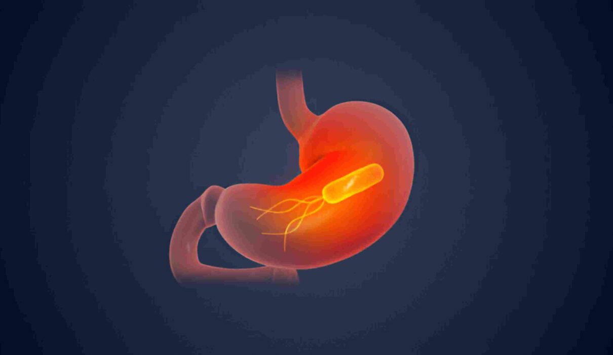 Erythematous Mucosa